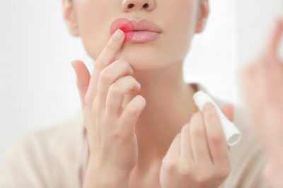Герпес на губах – причины, лечение и профилактика